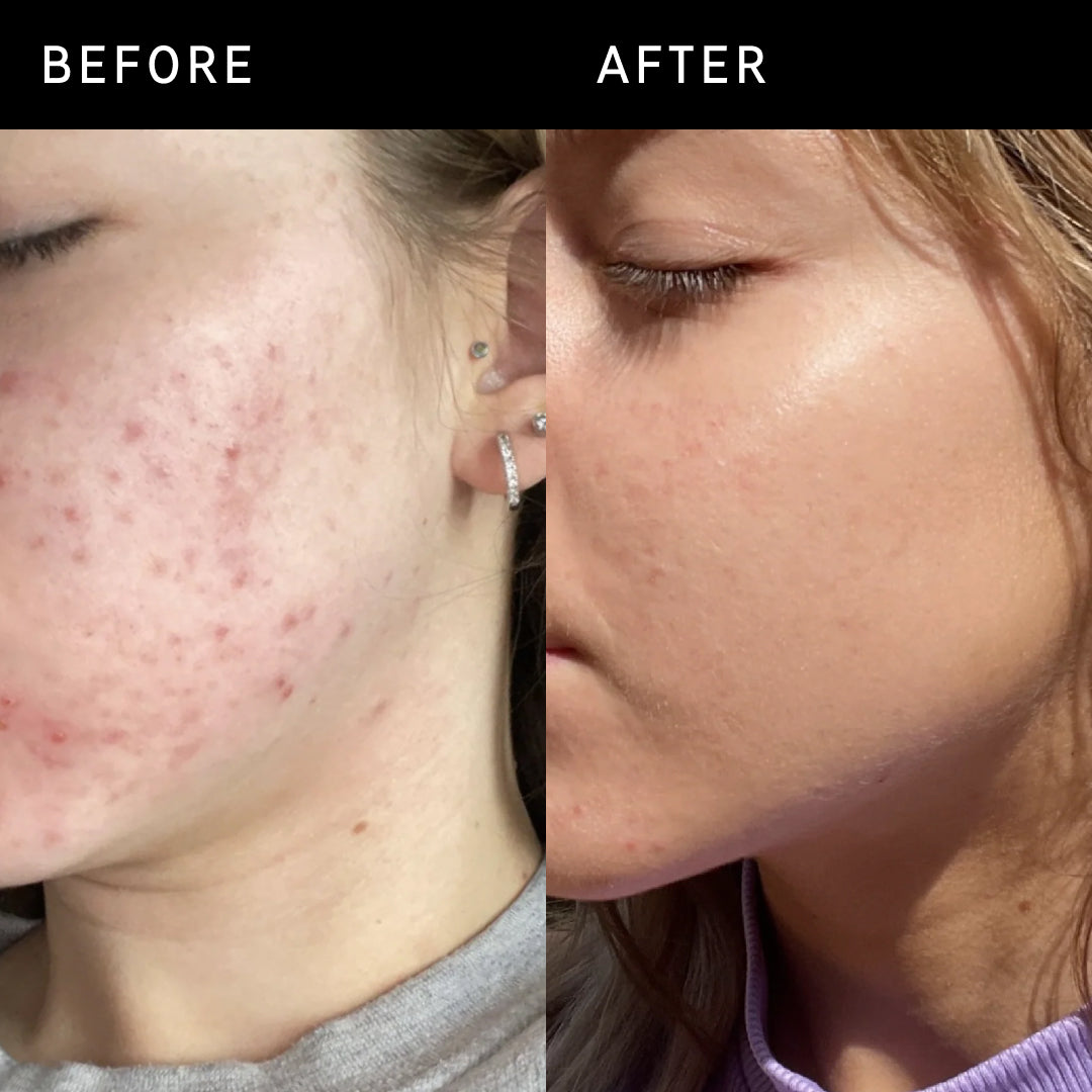 Inkey List Niacinamide Serum