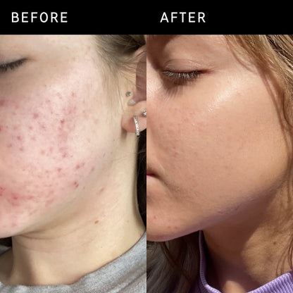 Inkey List Niacinamide Serum