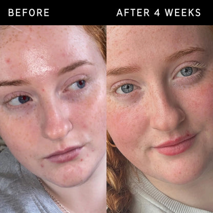 Inkey List Vitamin B, C and E Moisturizer