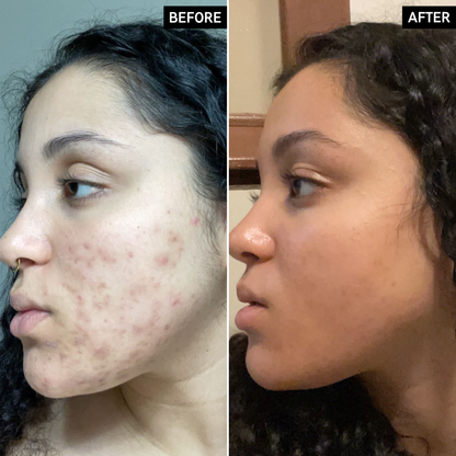 Inkey List Tranexamic Acid Serum
